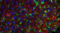 Cell image from a microscope